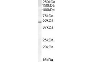 Western Blotting (WB) image for anti-DKFZp686H10114 (Middle Region) antibody (ABIN2779749) (DKFZp686H10114 (Middle Region) anticorps)