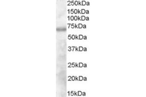 Western Blotting (WB) image for anti-Differentially Expressed in FDCP 6 Homolog (DEF6) (N-Term) antibody (ABIN2465595) (DEF6 anticorps  (N-Term))