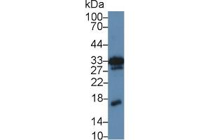 Western blot analysis of Mouse Kidney lysate, using Mouse MK Antibody (5 µg/ml) and HRP-conjugated Goat Anti-Rabbit antibody ( (Midkine anticorps  (AA 22-140))