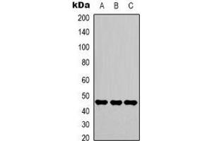 Western blot analysis of Gamma-enolase expression in Hela (A), Jurkat (B), 293T (C) whole cell lysates. (ENO2/NSE anticorps)
