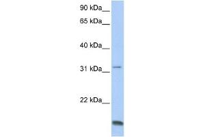 TCAP antibody used at 1 ug/ml to detect target protein. (TCAP anticorps)