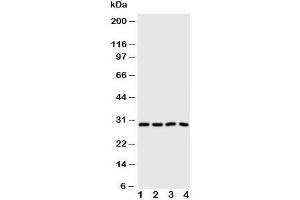 Western blot testing of Carbonic Anhydrase III antibody and Lane 1:  SMMC-7721;  2: HeLa;  3: SW620;  4: SCG cell lysate (CA3 anticorps  (N-Term))