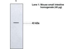 Image no. 1 for anti-Leukotriene B4 Receptor 2 (LTB4R2) antibody (ABIN2451486) (LTB4R2 anticorps)