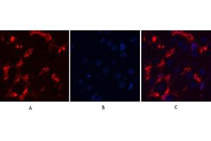 Immunofluorescence analysis of human liver tissue. (alpha-SMA anticorps)