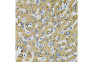 Immunohistochemistry of paraffin-embedded human liver injury using SDC4 Antibody (ABIN1874710) at dilution of 1:100 (40x lens). (SDC4 anticorps)