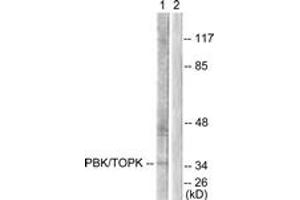 Western Blotting (WB) image for anti-PDZ Binding Kinase (PBK) (AA 1-50) antibody (ABIN2879108) (PBK anticorps  (AA 1-50))