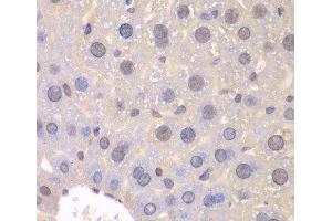 Immunohistochemistry of paraffin-embedded Mouse liver using FGFR1 Polyclonal Antibody at dilution of 1:100 (40x lens). (FGFR1 anticorps)