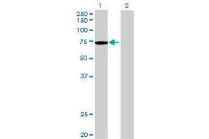 Lane 1: INPP5E transfected lysate ( 70. (INPP5E 293T Cell Transient Overexpression Lysate(Denatured))