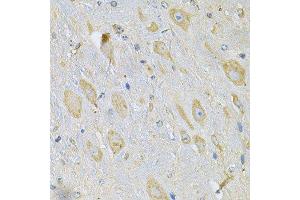 Immunohistochemistry of paraffin-embedded mouse brain using TXNDC5 Antibody. (TXNDC5 anticorps  (AA 1-324))