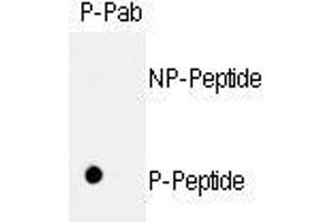 Image no. 1 for anti-Retinoblastoma 1 (RB1) (pSer811) antibody (ABIN358217) (Retinoblastoma 1 anticorps  (pSer811))