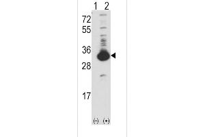 Western blot analysis of KHK (arrow) using rabbit polyclonal Ketohexokinase (KHK) Antibody (N-term) (ABIN391088 and ABIN2841229). (Ketohexokinase anticorps  (N-Term))