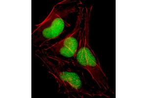 Immunofluorescence (IF) image for anti-SRY (Sex Determining Region Y)-Box 18 (SOX18) antibody (ABIN2998551) (SOX18 anticorps)