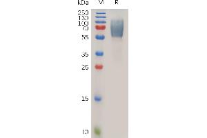 Endomucin Protein (EMCN) (AA 19-190) (Fc Tag)