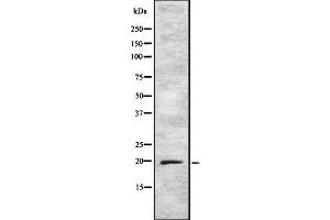 Western blot analysis of ARF5 using K562 whole cell lysates (ARF5 anticorps  (C-Term))