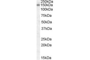 Western Blotting (WB) image for anti-Discs, Large Homolog 1 (DLG1) (AA 661-673) antibody (ABIN342982) (DLG1 anticorps  (AA 661-673))