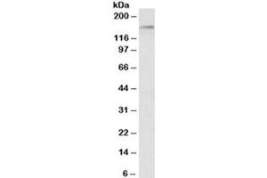 Western blot testing of HeLa nuclear lysate with HDAC6 antibody at 1ug/ml. (HDAC6 anticorps)