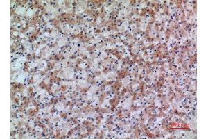 Immunohistochemistry (IHC) analysis of paraffin-embedded Human Liver, antibody was diluted at 1:100. (17beta-HSD4 (N-Term) anticorps)