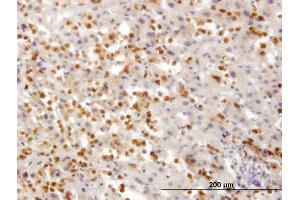 Immunoperoxidase of monoclonal antibody to TARS on formalin-fixed paraffin-embedded human liver. (TARS anticorps  (AA 44-143))