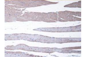 IHC-P analysis of Mouse Skeletal Muscle Tissue, with DAB staining. (CBR1 anticorps  (AA 66-271))