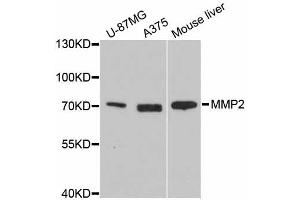 Western blot analysis of extracts of various cell lines, using MMP2 antibody. (MMP2 anticorps)