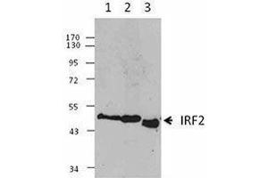 Western Blotting (WB) image for anti-Interferon Regulatory Factor 2 (IRF2) antibody (ABIN2665203) (IRF2 anticorps)