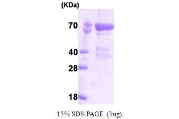 PAK4 Protein (AA 1-591) (His tag)