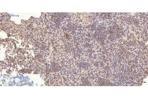 Immunohistochemistry of paraffin-embedded Mouse lung tissue using CD10 Monoclonal Antibody at dilution of 1:200. (MME anticorps)