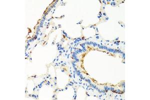Immunohistochemistry of paraffin-embedded rat lung using RGS5 antibody (ABIN5975077) at dilution of 1/100 (40x lens). (RGS5 anticorps)