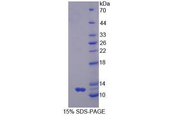 GNG2 Protein (AA 2-71) (His tag)