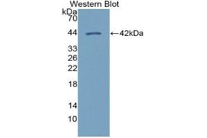 Western blot analysis of the recombinant protein. (CXCL14 anticorps  (AA 35-111))