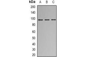 Western blot analysis of Nibrin expression in HEK293T (A), A549 (B), Jurkat (C) whole cell lysates. (Nibrin anticorps)