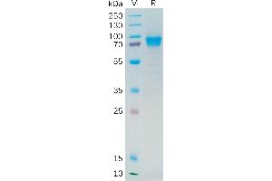 Human IL21R Protein, hFc Tag on SDS-PAGE under reducing condition. (IL21 Receptor Protein (AA 20-232) (Fc Tag))