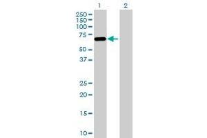 Lane 1: PLAT transfected lysate ( 62. (PLAT 293T Cell Transient Overexpression Lysate(Denatured))