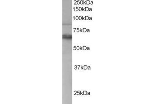 ANTXR1 anticorps  (C-Term)