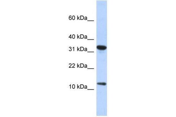 BTF3P11 anticorps  (N-Term)