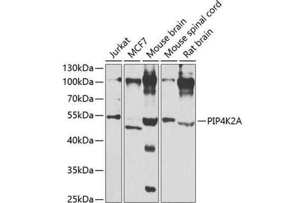 PIP4K2A anticorps  (AA 120-350)