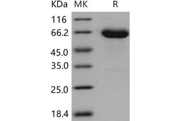 EPH Receptor A6 Protein (Epha6) (His tag)