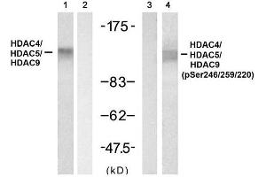 Western blot analysis of extracts from 3T3 cell using HDAC4/ HDAC5/HDAC9 (Ab-246/259/220) Antibody (E021517, Lane 1 and 2) and HDAC4/ HDAC5/HDAC9 (phospho- Ser246/ 259/ 220) Antibody (E011517, Lane 3 and 4). (HDAC4/HDAC5/HDAC9 anticorps)