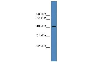 WB Suggested Anti-PSMC6 Antibody Titration: 0. (PSMC6 anticorps  (C-Term))