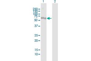 Western Blot analysis of FEZ1 expression in transfected 293T cell line ( H00009638-T01 ) by FEZ1 MaxPab polyclonal antibody. (FEZ1 anticorps  (AA 1-392))