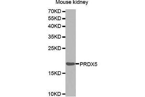 Western Blotting (WB) image for anti-Peroxiredoxin 5 (PRDX5) (AA 53-214) antibody (ABIN6216418) (Peroxiredoxin 5 anticorps  (AA 53-214))