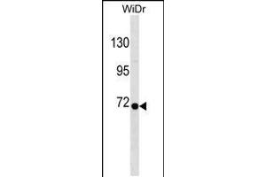 Western blot analysis in WiDr cell line lysates (35ug/lane). (RPN1 anticorps  (C-Term))