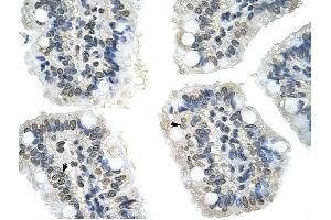 GIPC2 antibody was used for immunohistochemistry at a concentration of 4-8 ug/ml to stain Epithelial cells of intestinal villus (arrows) in Human Intestine. (GIPC2 anticorps  (N-Term))