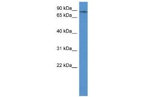 WB Suggested Anti-ADD3 Antibody Titration: 0. (ADD3 anticorps  (C-Term))