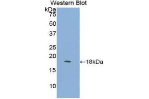 Western blot analysis of the recombinant protein. (LY96 anticorps  (AA 16-160))