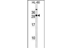 Western blot analysis in HL-60 cell line lysates (35ug/lane). (STXBP6 anticorps  (AA 71-97))