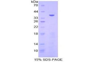 SDS-PAGE analysis of Human Meprin A alpha Protein. (MEP1A Protéine)