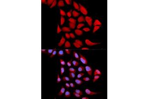 Immunofluorescence analysis of U2OS cells using PSMA6 antibody. (PSMA6 anticorps)