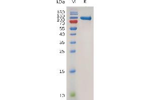 Human (20-707) Protein, His Tag on SDS-PAGE under reducing condition. (MMP 9 Protein (AA 20-707) (His tag))