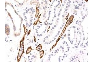 Formalin-fixed, paraffin-embedded human kidney transplant stained with Complement 4d antibody (SPM545). (Complement C4d anticorps)